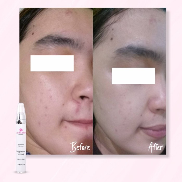 Airin Advance Brightener Serum BPOM