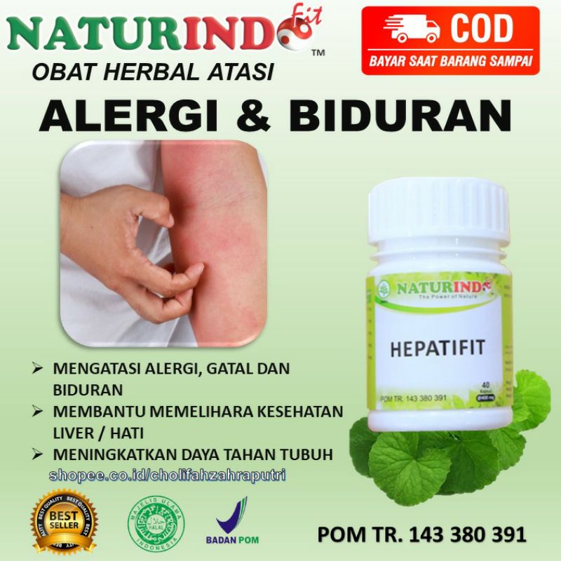 Obat Gatal Gatal, Alergi, Biduran Pada Kulit Herbal Alergi Gatal Kulit Biduran Ampuh HEPATIFIT
