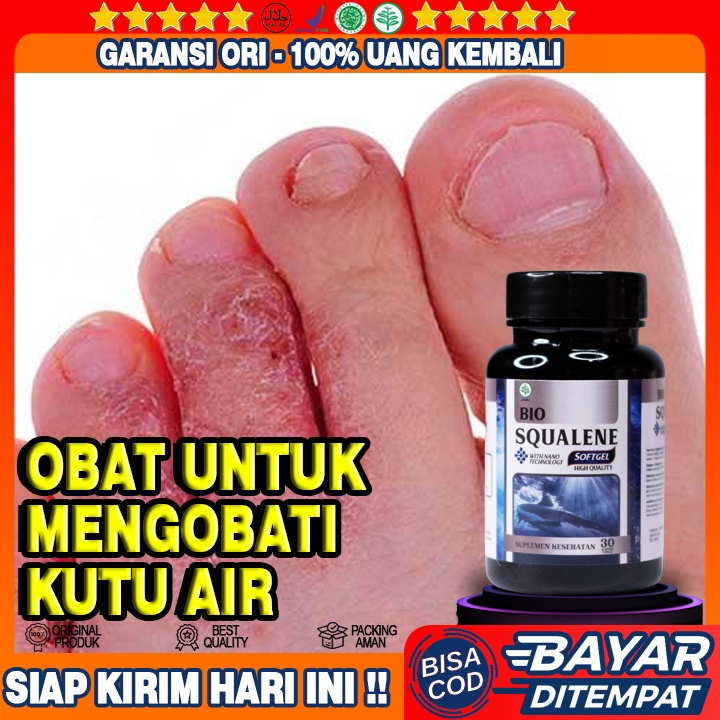 Obat Kutu Air -  Meredakan Perih Kutu Air - Obat Kutu Air Pada Kaki  - Obat Penghilang Kutu Air Di K