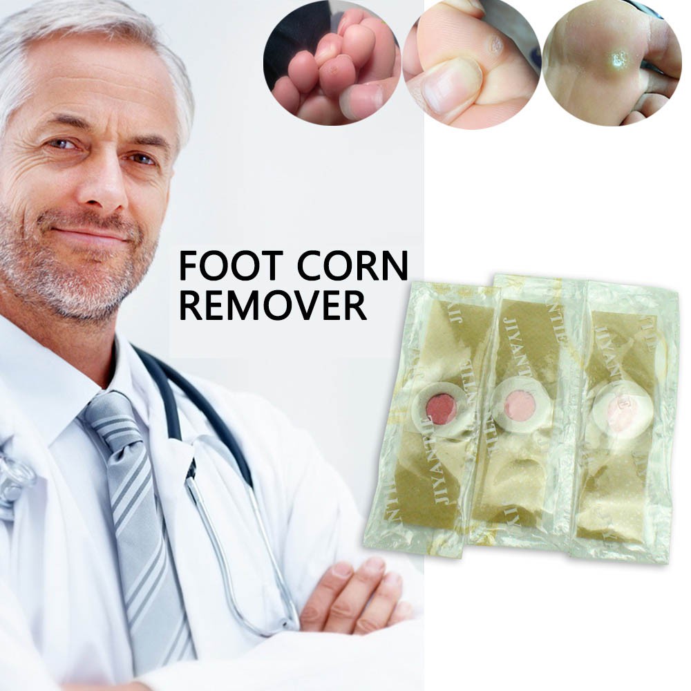 [100% Ampuh] Plester Kutil Mata Ikan Obat Kutil Mata Ikan Tahi Lalat Plester Kutil Penghilang Pencabut Kaki Leher Wajah Foot Corn Removal Plaster