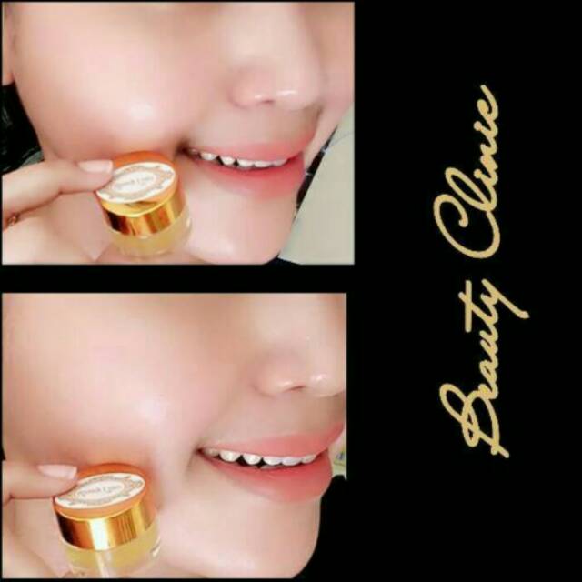 ready spw serum pelicin wajah super ampuh beauty clinic gel