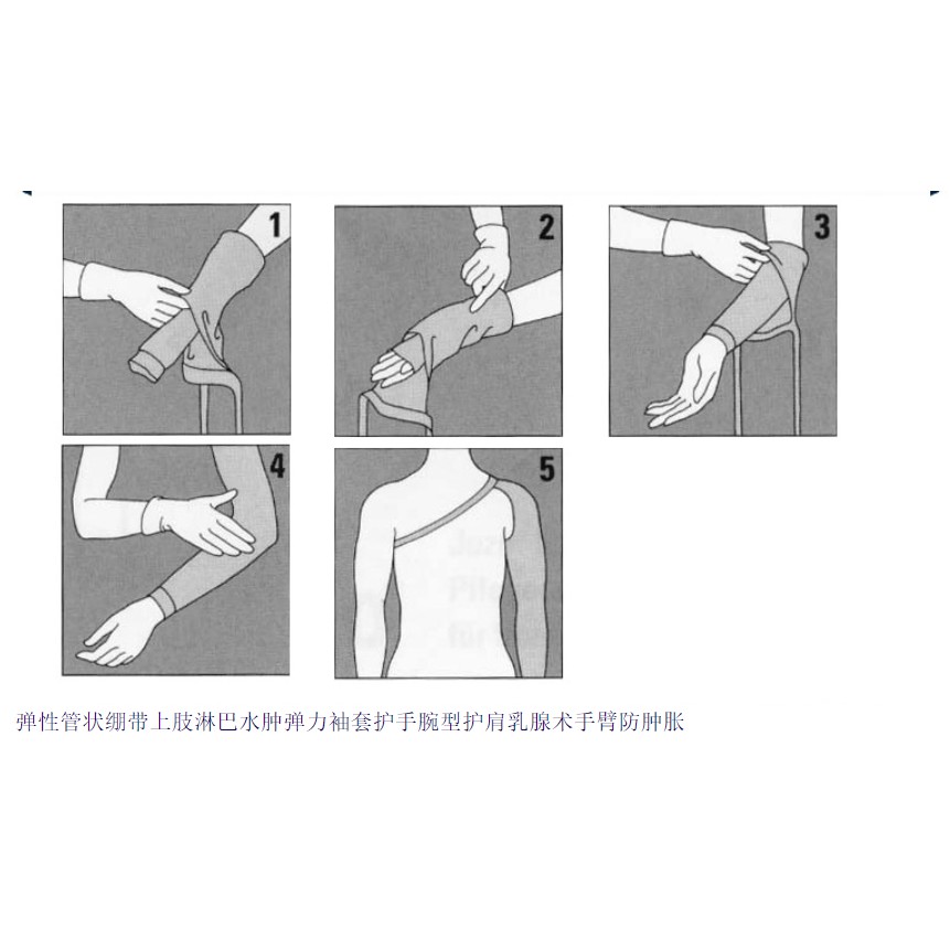 Arm Sleeve Lymphedema With Belt Compression Manset Pasca Mastectomy AH