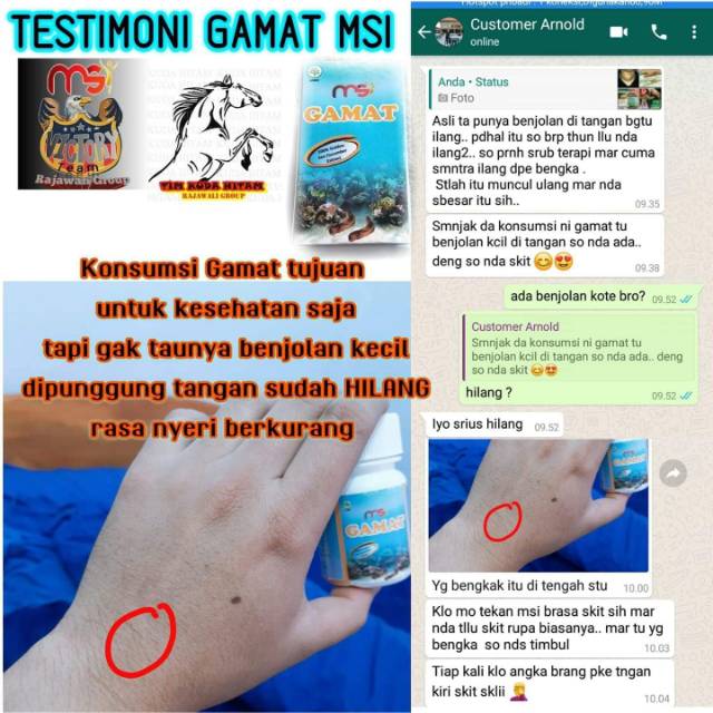 Gamat msi original boom anti penuanandimi