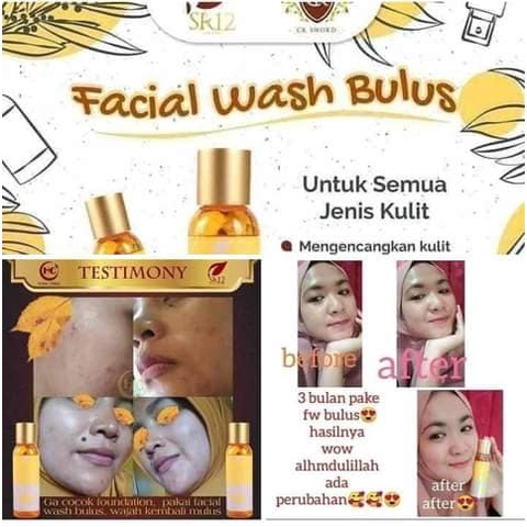 Facial Wash SR12 | Facial Wash Bulus &amp; Facial Wash Honey | Sabun Wajah SR12 Skincare
