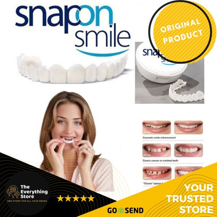 Set Veneer Pelapis Gigi Ompong | Sepasang Atas dan Bawah