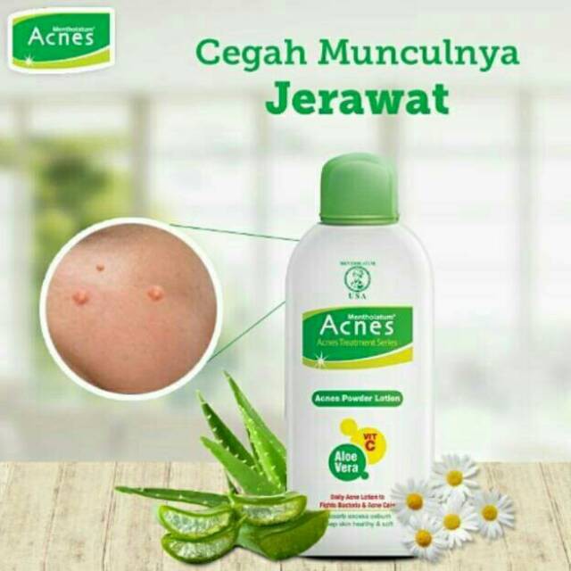 ACNES Natural Care Oil Control Series Milk Cleanser/ Toner / Powder Lotion / Cream jerawat_Cerianti