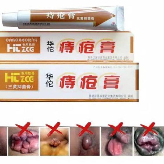 SLL-212 SALEP OBAT WASIR AMBEIYEN AMBIEN HERBAL CINA HUATUO ZHICHUANG GAO 100% ORIGINAL .,..,.,.,.