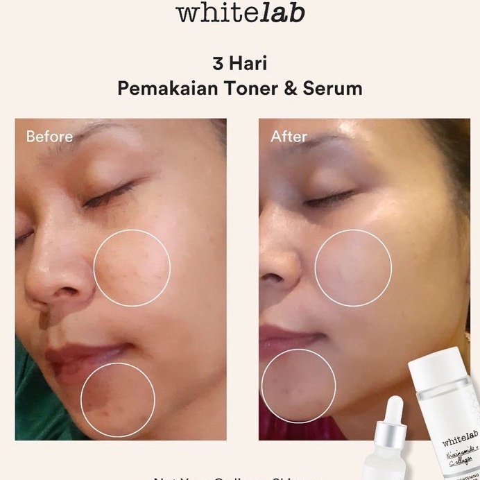 [COD] Whitelab Brightening Face Toner dengan Niacinamide &amp; Collagen AMPUH Mengangkat Minyak Berlebih