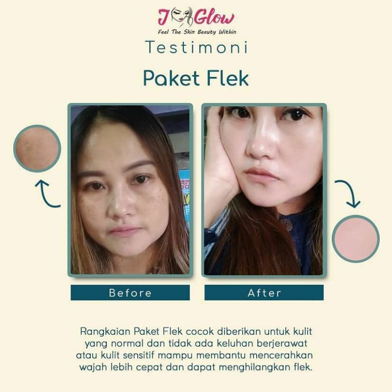 Jglow Skincare Paket Flek Peeling Serum Whitening Cream Skin glowing Perawatan Wajah Kecantikan Bpom-6