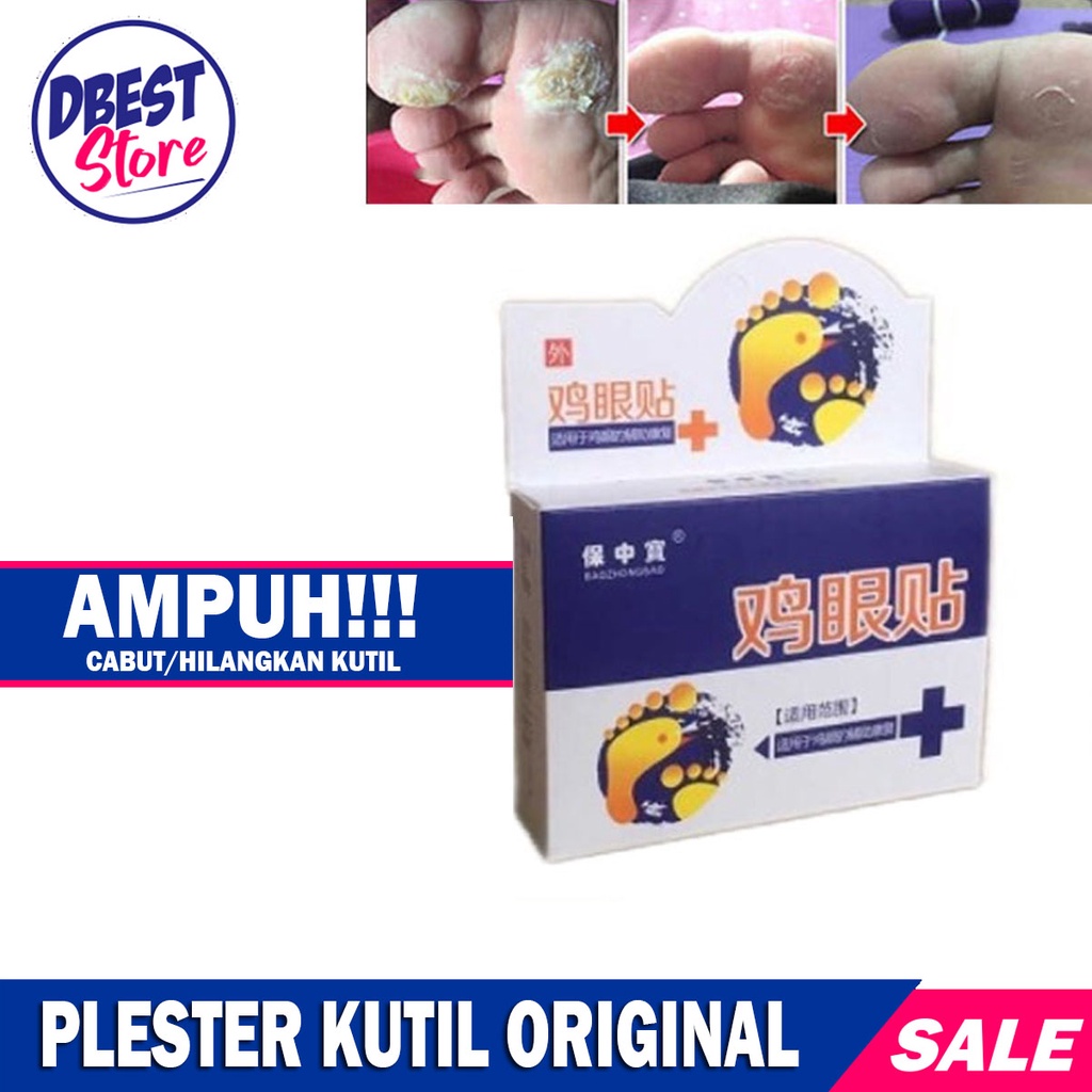 (1Box isi 6 Pcs) Plester Obat Kutil &amp; Mata Ikan / Kapalan Koyo Kutil / Plester Obat Penghilang Kutil