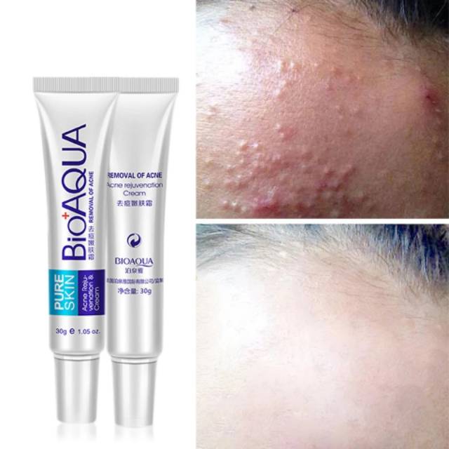 BIOAQUA ACNE REJUVENATION & CREAM PURE SKIN / OBAT JERAWAT AMPUH