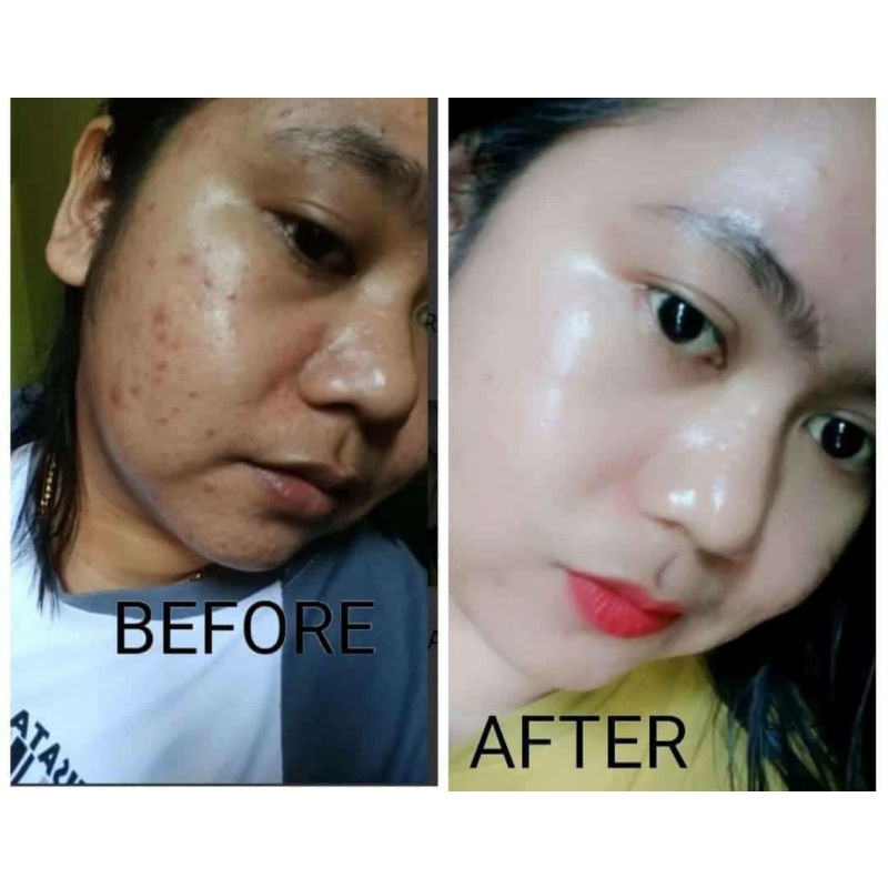 PAKET SKINCARE PEMUTIH WAJAH - CREAM BPOM NR GLOW RJN SKINCARE CEPAT PUTIH,GLOWING