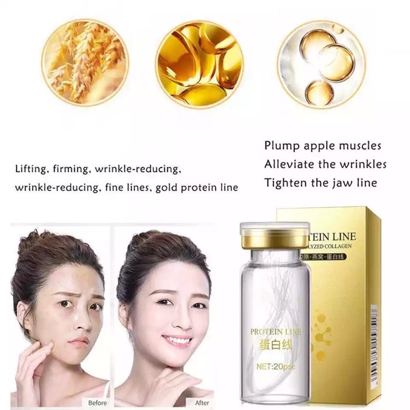 Tanam benang tanpa jarum,perawatan wajah benang collagen