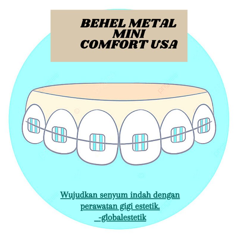 Behel Metal Mini Comfort USA-2 Rahang