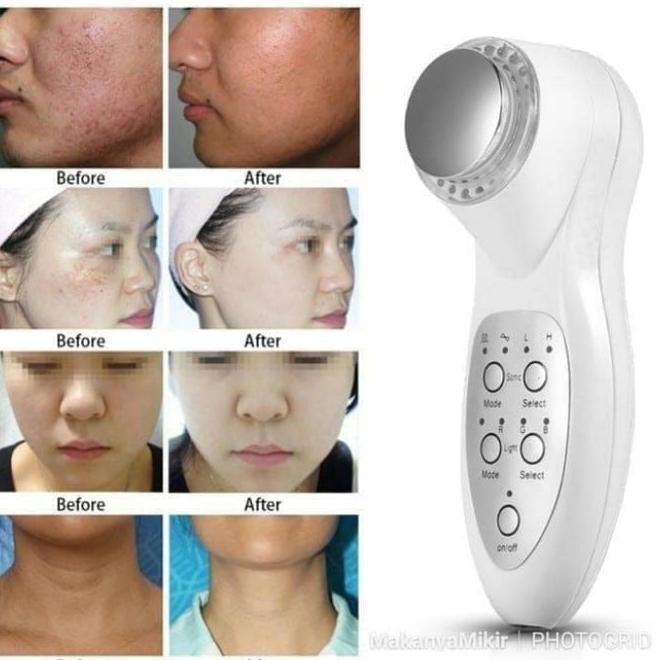 Alat Kecantikan Wajah.Facial Detox