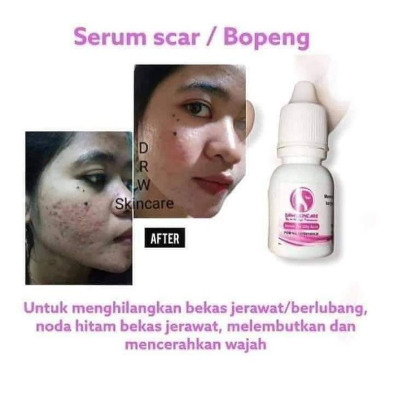 serum scar DRW skincare