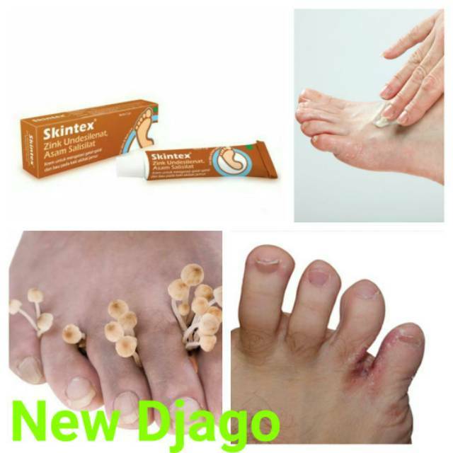 SKINTEX  Salep GATAL DAN BAU KAKI AKIBAT JAMUR
