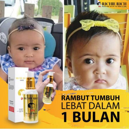  RICHIE  RICH  SERUM Vitamin  Penumbuh Penyubur Rambut  Bayi 