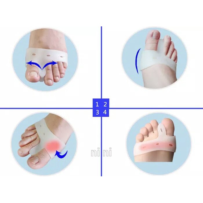 2pcs Big Toe Bunion Splint Straightener corrector Hallux Valgus Bunion