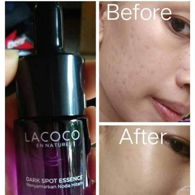 LACOCO - Dark Spot Essence