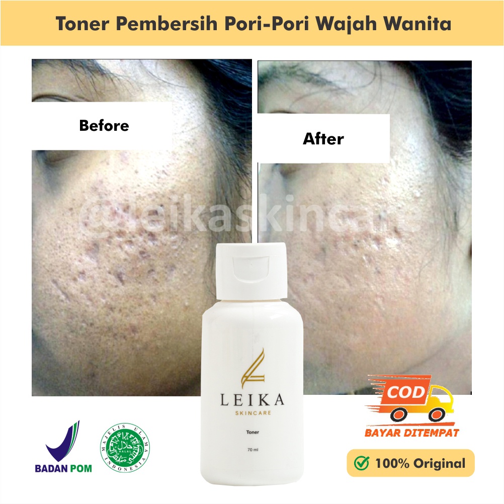 Pembersih Wajah Wanita Pembersih Pori Pori Wajah Toner Wajah Pengecil Pori Pori Wajah Ampuh Pembersi