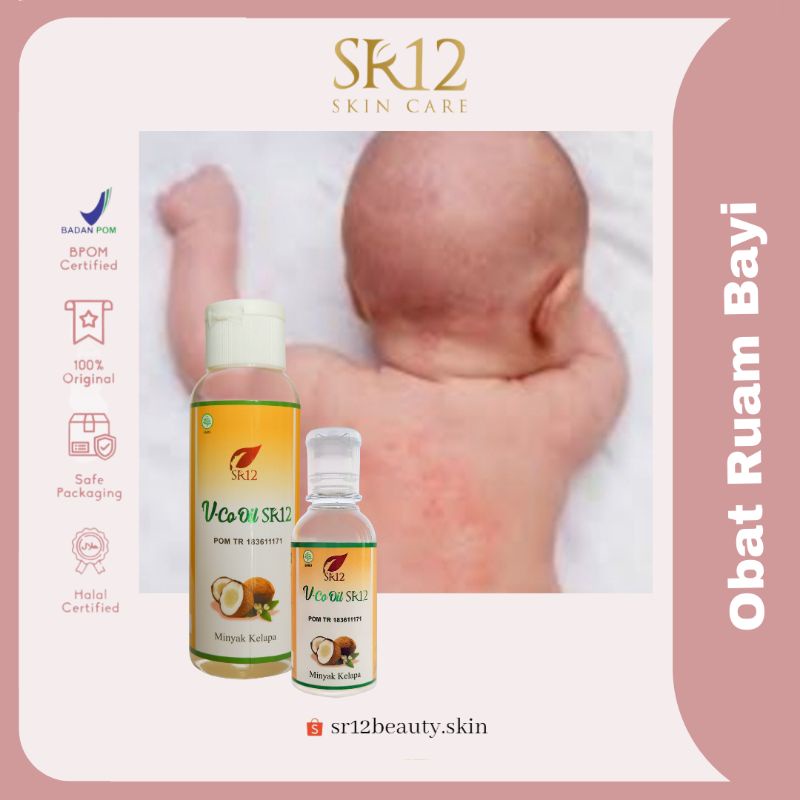 Obat Gatal Gatal Bayi - Ruam Popok - Bruntusan - Biang Keringat 100% Alami