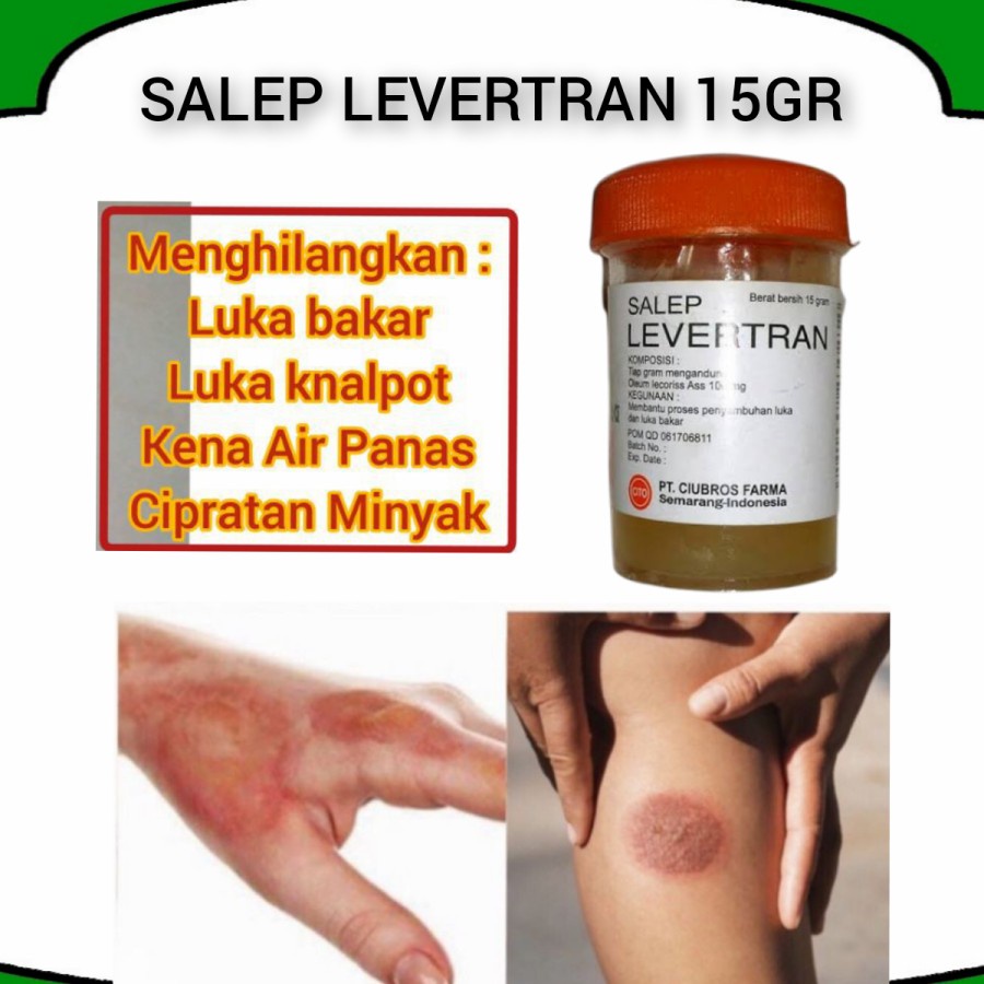 SALEP LEVERTRAN OBAT LUAR AMPUH MEMBANTU PROSES PENYEMBUHAN LUKA DAN LUKA BAKAR-Asli Original Salep 