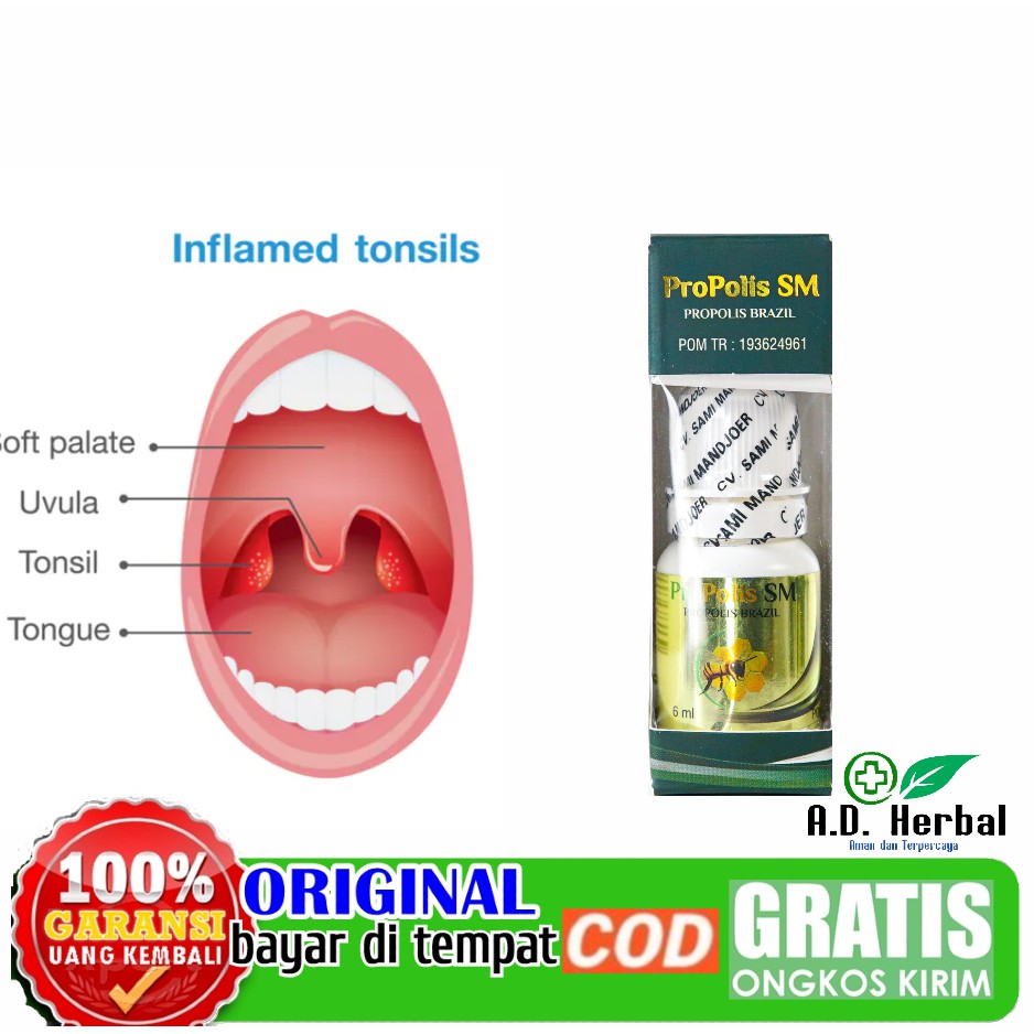 

Obat amandel Anak dewasa radang tenggorokan kering faringitis sakit perih nyeri menelan PROPOLIS