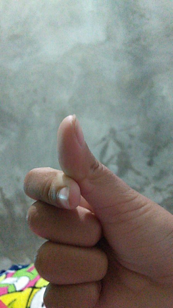 Cetakan Lontong Aluminium Press Satuan