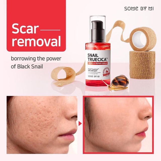 Some by mi Serum