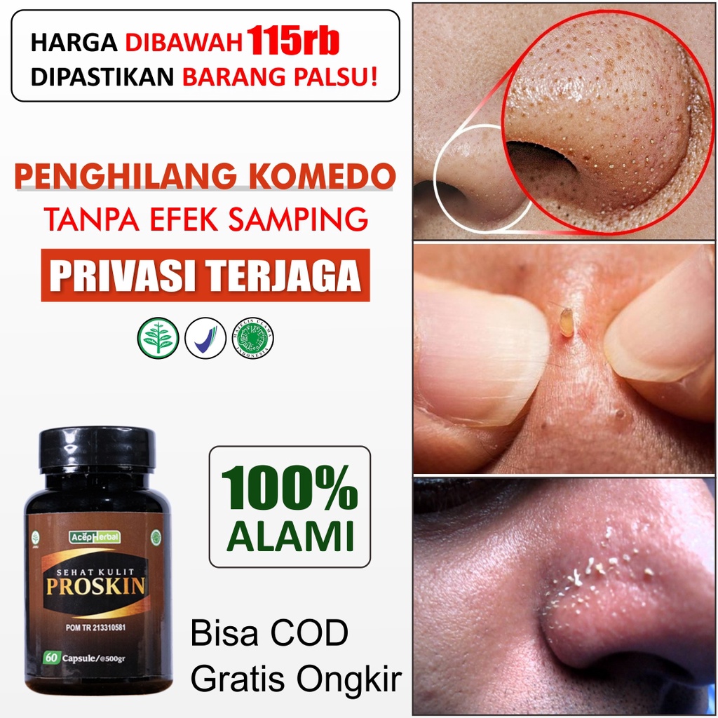 Penghilang Komedo Obat Flek Hitam Membandel Pembersih Wajah Pengecil Poripori Pria Menghilangkan Bek