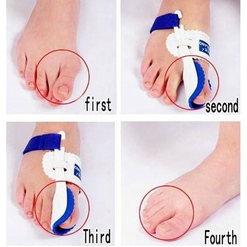 ALAT TERAPI JEMPOL KAKI BUNION PAD PELURUS JEMPOL KAKI, HALLUX VALGUS SPLINT