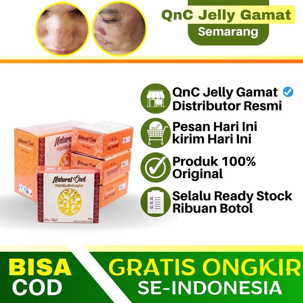 Penghilang Flek Hitam di Hidung dan Pipi Pria Wanita Penghilang Noda Hitam Penghilang Flek Hitam di 