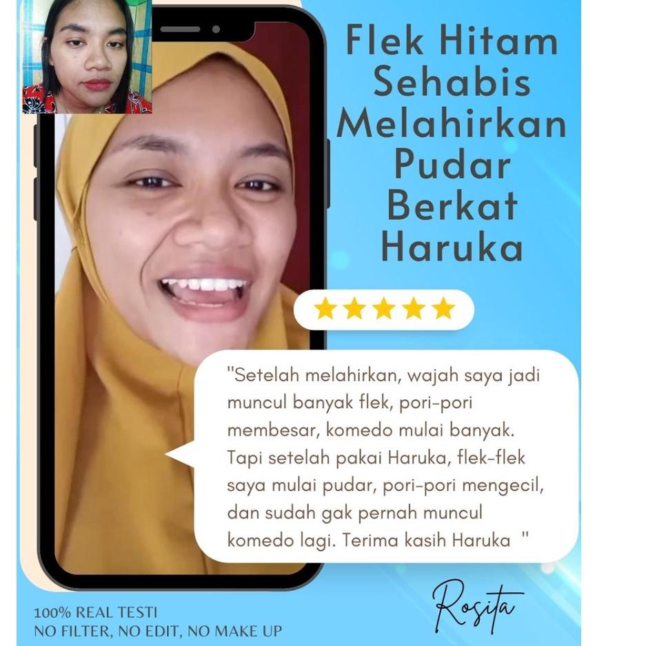 Big Sale Paket Skincare Haruka untuk Kulit Flek NS1A