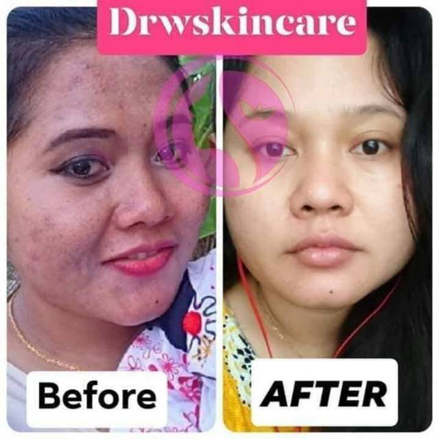 Paket Drw skin care original