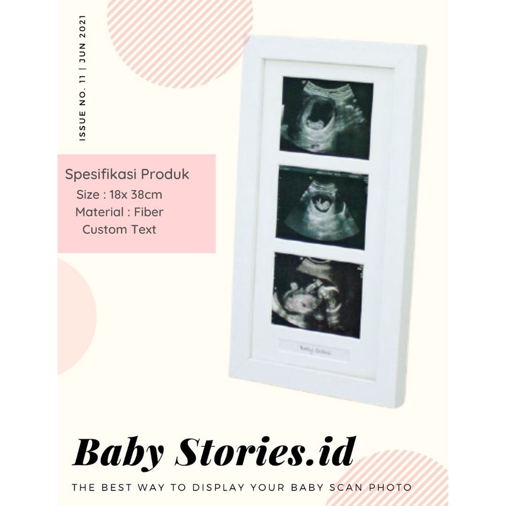 BINGKAI FOTO/ FRAME FOTO BAYI USG CUSTOM UNIK 3 FOTO VERTIKAL