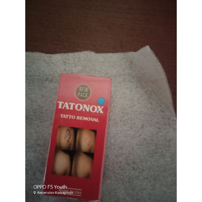 tatonox penghilang tato