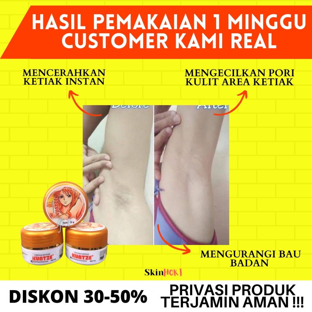 PEMUTIH KETIAK DAN SELANGKANGAN PERONTOK DAKI KUNTZE CREAM PEMUTIH KETIAK 10GR PENGHILANG BAU KETIAK ORIGINAL BPOM