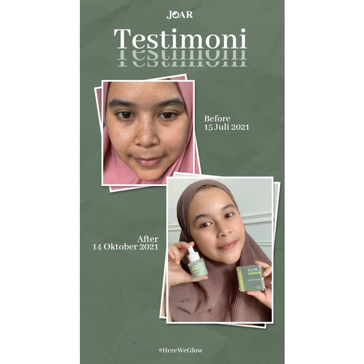 BISA COD !! Joar Brightening Face Serum + Brightening Soap Bar BPOM HALAL - Sabun Muka Pria Jerawat - Sabun Wajah Pemutih Glowing - Obat Jerawat Ampuh