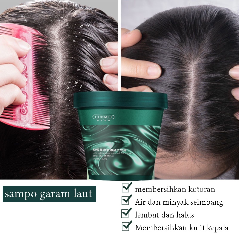 shampo anti ketombe 200g  gatal Shampo Perawatan Kulit Kepala Efektif memelihara kulit dan menumbuhkan rambut bergizi