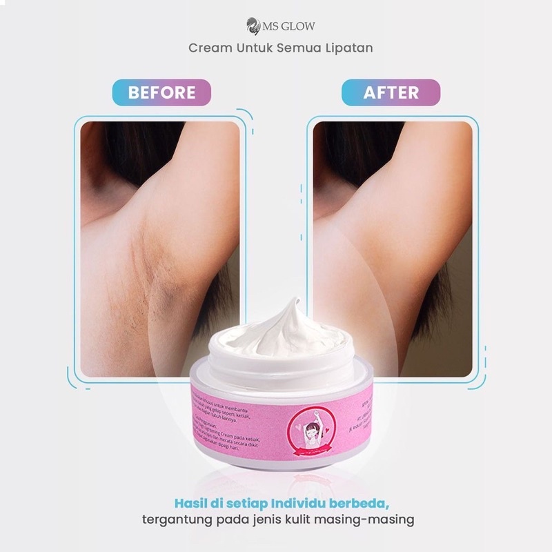 MS Glow Underarm Cream 15gr Krim Ketiak Lipatan Hitam MSGLOW Beauty