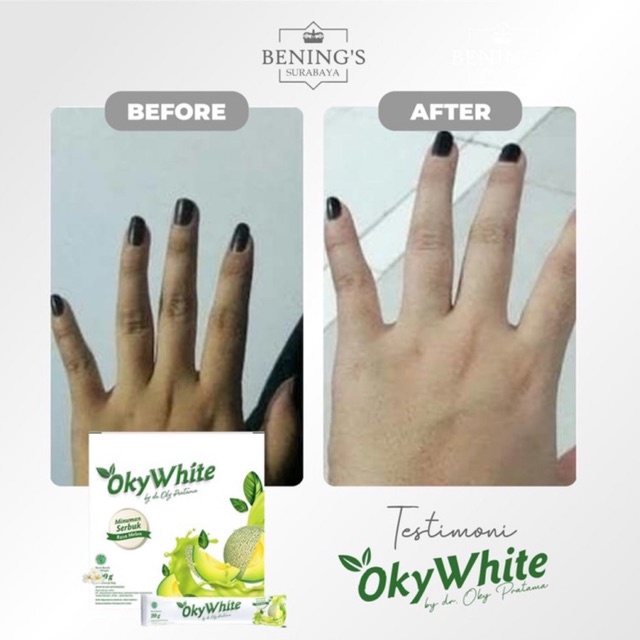 BENING'S OKYWHITE | MEMUTIHKAN &amp; MENCERAHKAN KULIT | BPOM &amp; HALAL | FREE GIFT SIAP KIRIM SELURUH INDONESIA