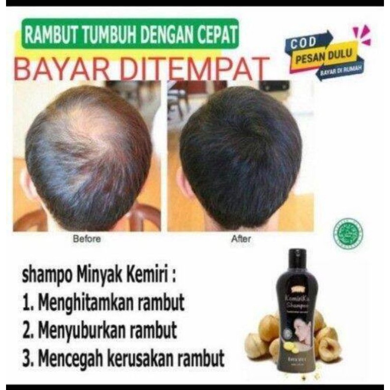 Shampo kemiriku Original menghilangkan uban Bpom