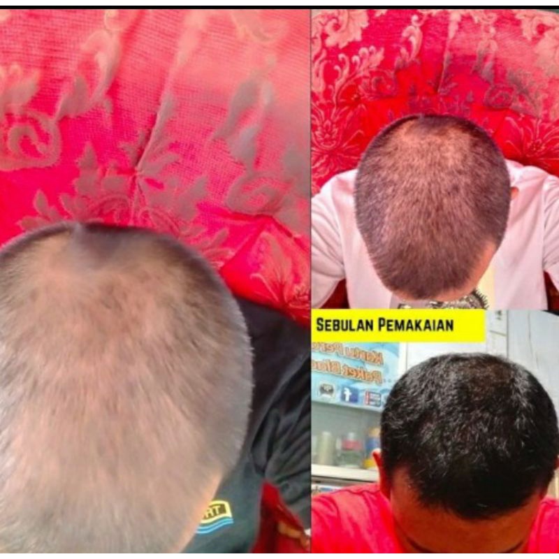 [FREE MINIGOLD] KELAYA SHAMPOO / Shampo Penumbuh Rambut Botak Rontok Hilang