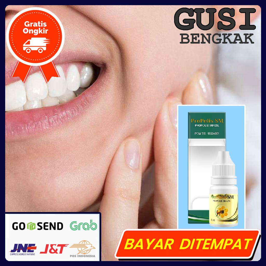 Obat Radang Gusi Bengkak - Gusi Berdarah - Infeksi Gusi - Tukak Gusi