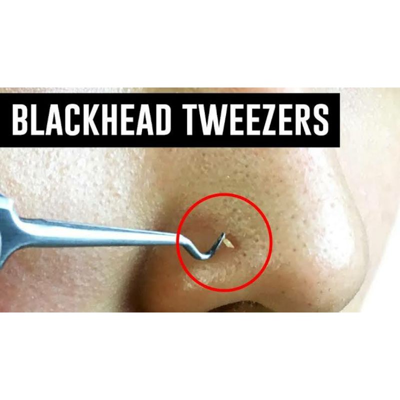 PINSET PENJEPIT PENCABUT KOMEDO JERAWAT / BLACKHEAD ACNE TWEEZER