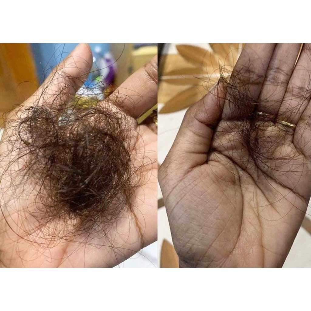 BIO HERBAL GINSENG PAKET SHAMPOO - HAIR TONIC - PENUMBUH RAMBUT BOTAK - TONIC RAMBUT PENUMBUH RAMBUT