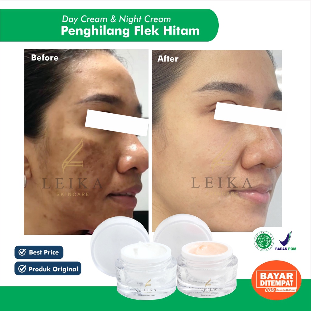 EFEKTIF Paling Ampuh Penghilang Flek Hitam Bintik Hitam Cream flek hitam  penghilang Plek hitam Memb