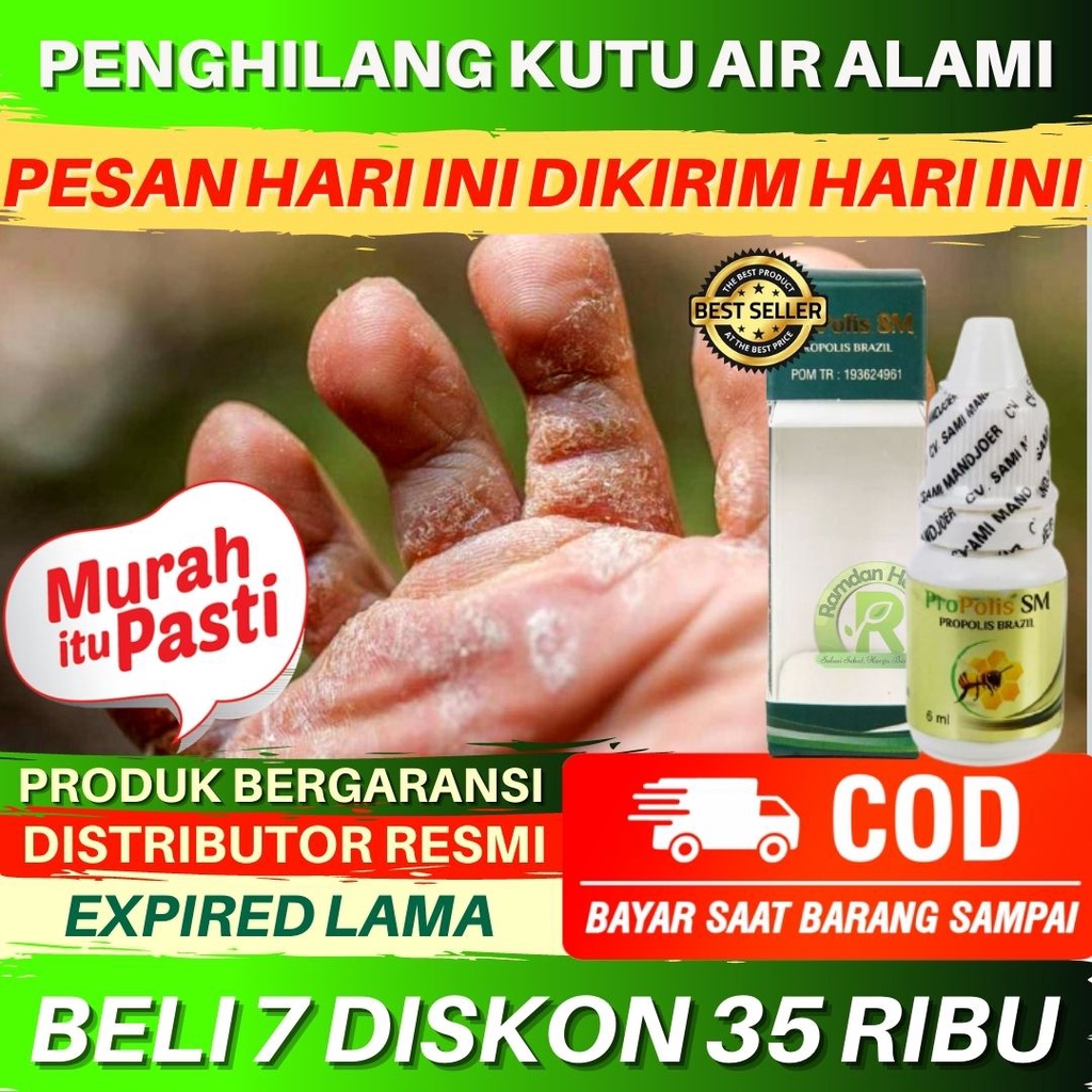 Jual Obat Penghilang Kutu Air Di Jari Kutu Air Di Tangan Kutu Air Di Sela Sela Jari Kaki Dan 3883