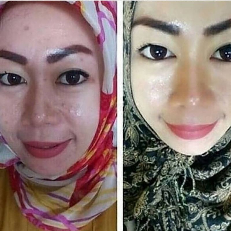 serum red jelly